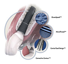 key features_biomanagement complex